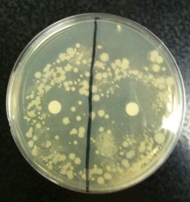 Science Experiments for High School Disinfectants Petri dish divided in half with bacteria and paper disks on the surface